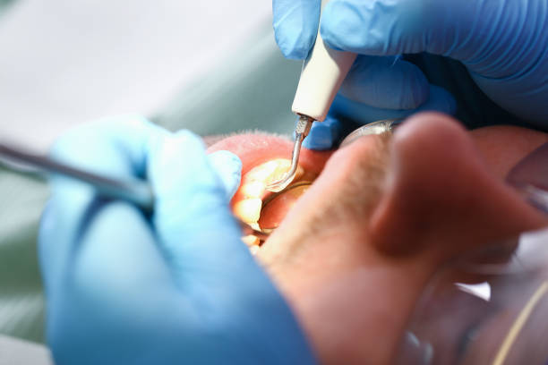 Best Emergency Dental Extractions in Bradford, RI