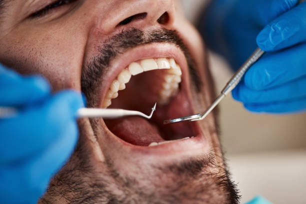 Best Urgent Dental Care for Toothache in Bradford, RI